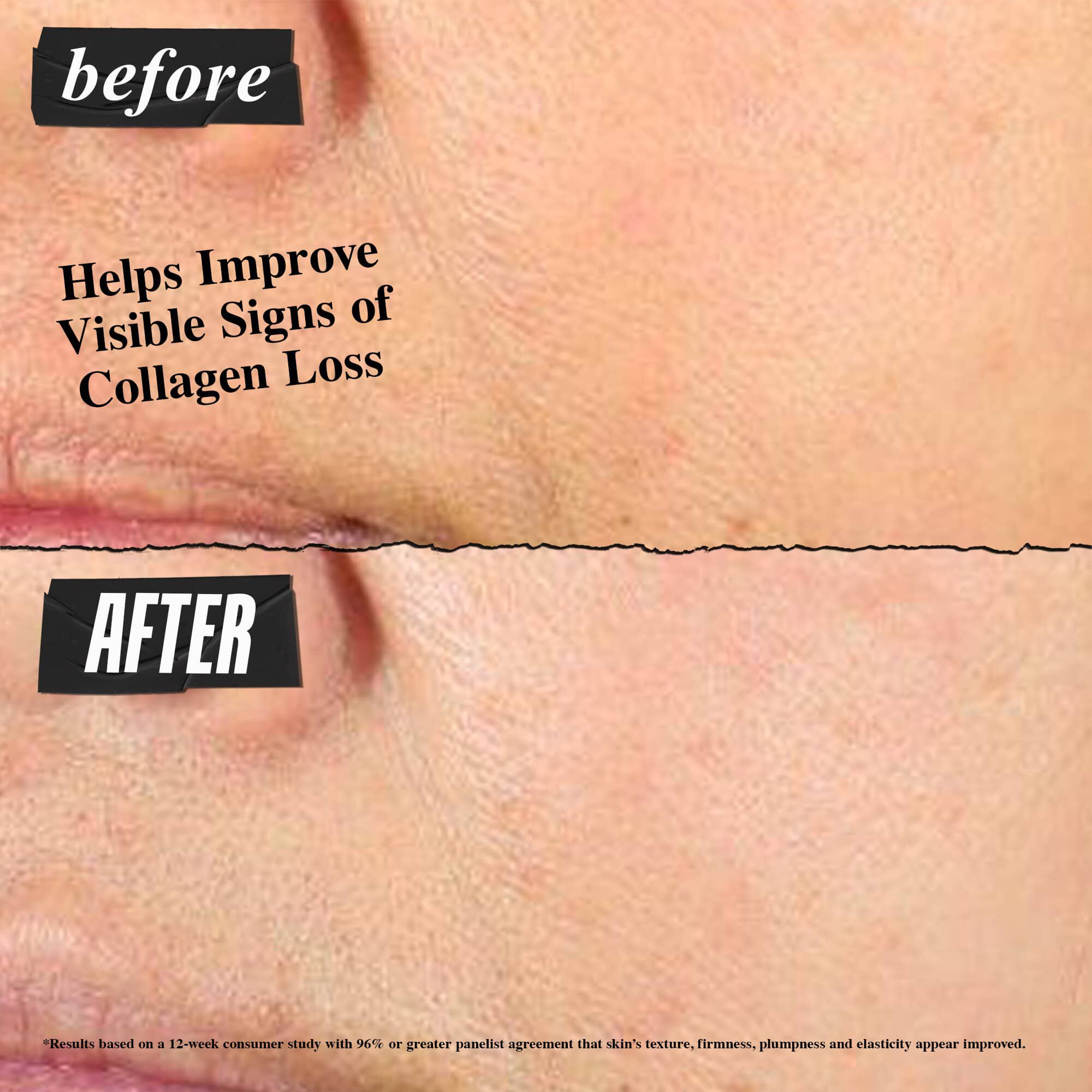 Super Multi Corrective Cream. Face moisturizer, pore